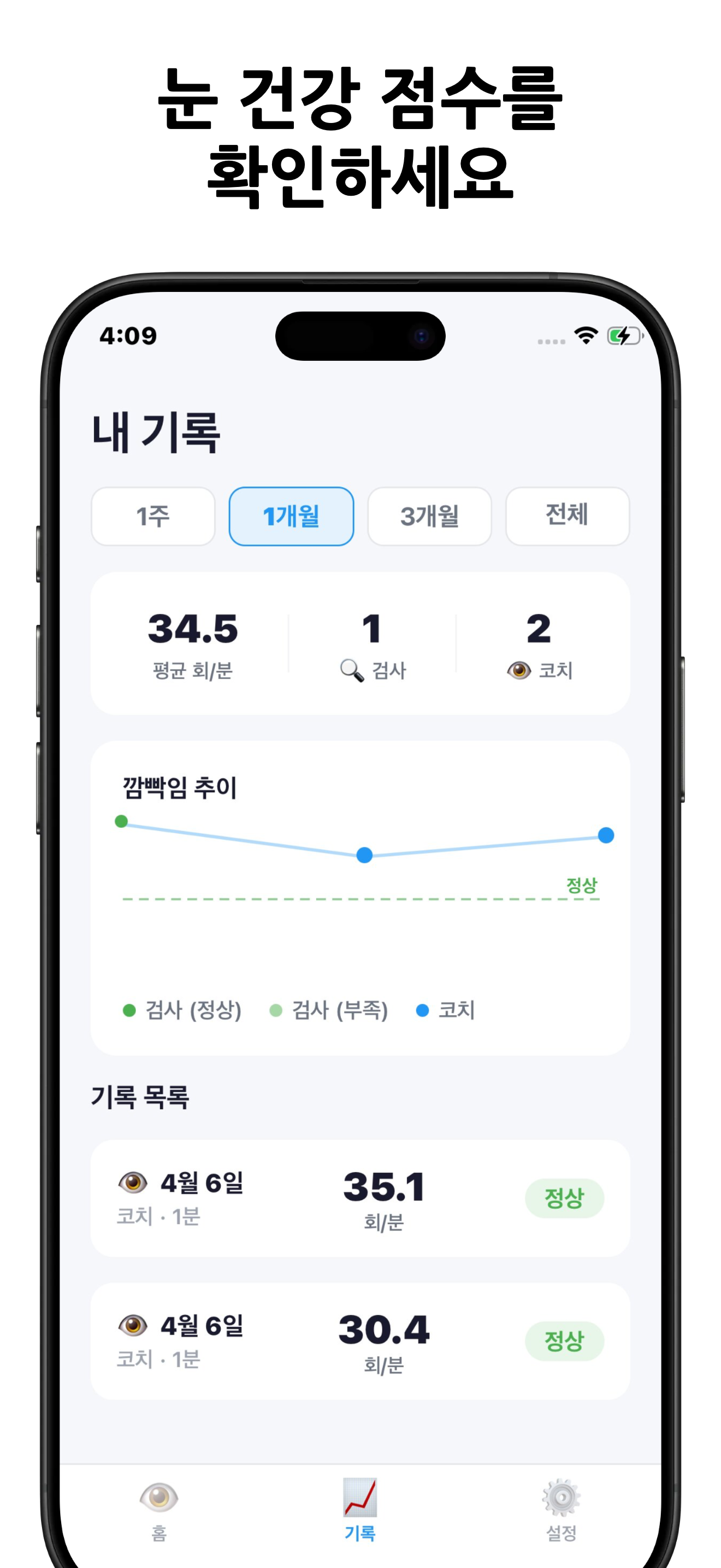 눈을감자 리포트 화면 예시